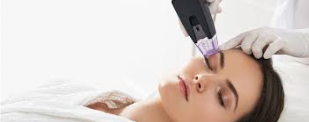 Morpheus8 Dubai: Advanced Skin Rejuvenation for Smoother Skin