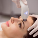 Laser Skin Resurfacing