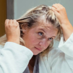 hair replacement