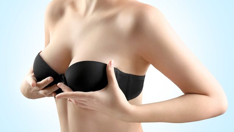 Breast Lift