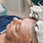 Hair Transplant Ras Al Khaimah