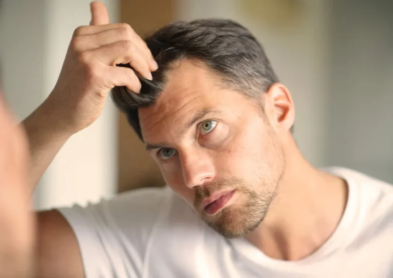 hair loss clinic UK