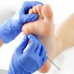 Senior Footcare Services for Better Mobility in Edinburgh