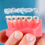 Transform Your Smile with Confidence: Expert Dental Implants & Braces in Houston