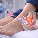 tendonitis treatment Dubai,