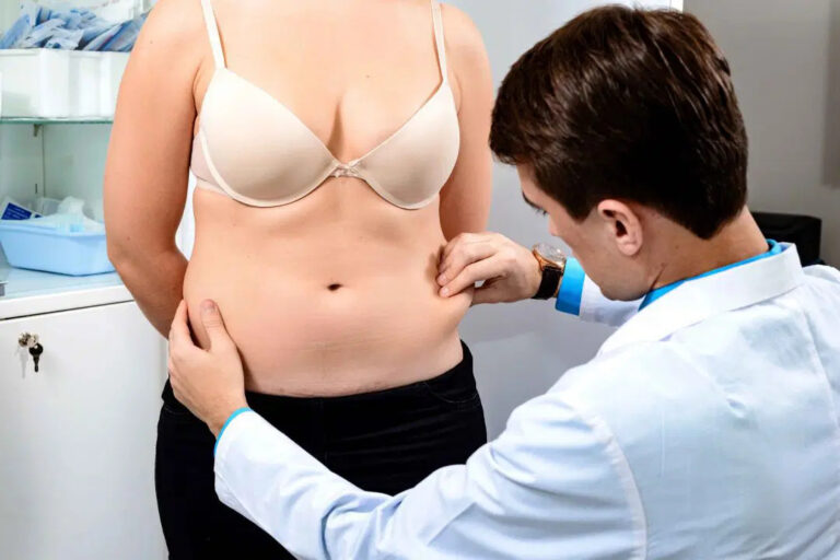 tummy tuck