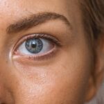 Do Under Eye Fillers Really Work for Hollows