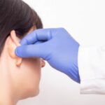 How to Choose the Best Otoplasty Surgery Clinic in Dubai