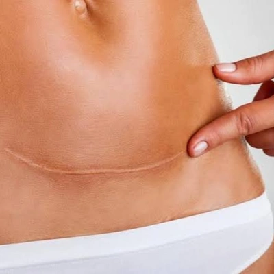 Post-surgery digestive complications and warning signs during recovery
