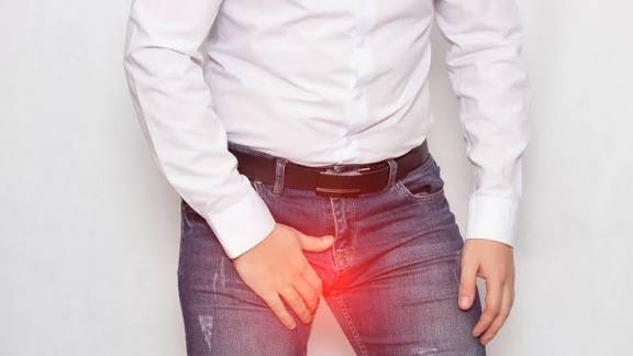 Hydrocele supplement guide for supporting nutritional wellness and managing scrotal swelling