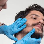 Beard Hair Transplant in Dubai