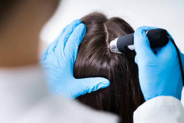 Close-up Of Dermatologist Using Trichoscope For Hair Fall Treatment His Clinic
