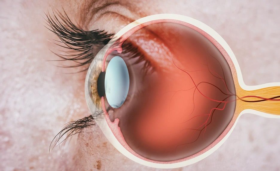 best eye hospital in panipat