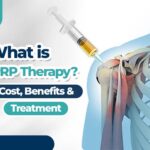prp therapy