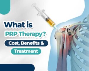 prp therapy