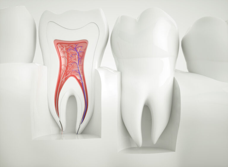 Protect Infected Teeth with Root Canal Therapy in Boulder, CO