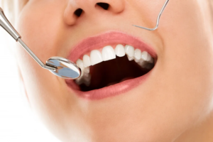 Maintain Healthy Smiles with Family Dentistry in Little Rock, AR