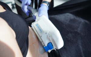 Can CoolSculpting Help Sculpt My Hips
