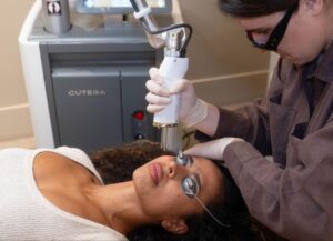 Can Picosure Laser Treatment Refine Complexion For Soft Texture