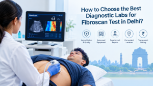 FibroScan test in Delhi, best diagnostic labs for FibroScan in Delhi, FibroScan test cost in Delhi, liver FibroScan test, liver elastography test Delhi, FibroScan scan near me, diagnostic labs in Delhi, liver health test, FibroScan test accuracy