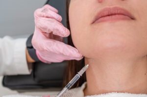 Double Chin Removal