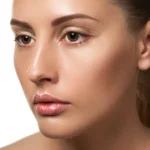 Rhinoplasty