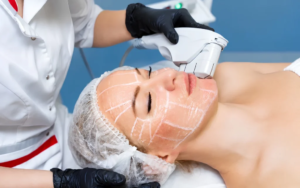 Skin Tightening