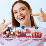 Dental Implants Explained: A Strong Foundation for Your New Smile Restore Your Bite and Confidence
