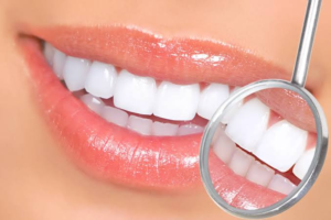 Achieve a Whiter Smile with Teeth Whitening in Louisville, KY