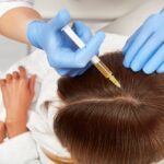 PRP For Hair Treatment in Dubai