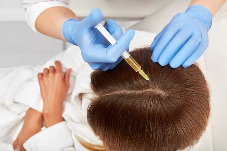 PRP For Hair Treatment in Dubai