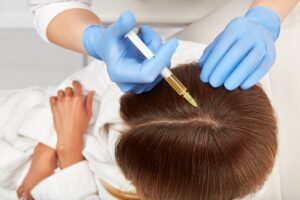 PRP For Hair Treatment in Dubai