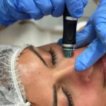 Hydrafacial