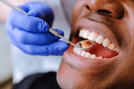 Strengthen Worn or Broken Teeth with Dental Crowns in Sioux Falls, SD