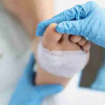 Wound care services in Troy, Michigan